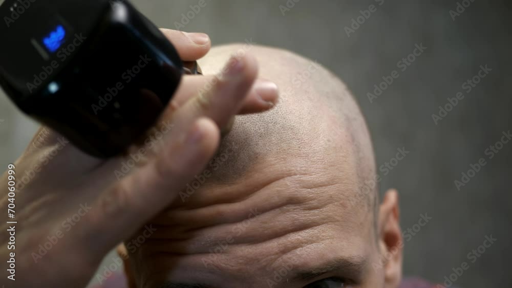 Close-up of the head of a bald man who shaves his bald head with an electric razor. a man who has lost his hair takes care of his hair and scalp. Middle-aged man with short hair cuts his own hair. Close-up of the head of a bald man who shaves his bald head with an electric razor. a man who has lost his hair takes care of his hair and scalp. Middle-aged man with short hair cuts his own hair.
