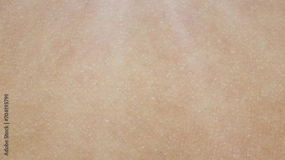 3D Animation Cream Drop Skin Acne Repair Effect