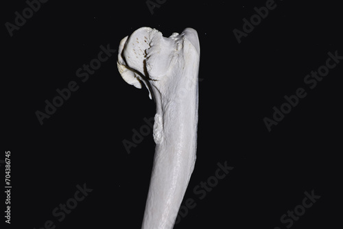 Exostosis on bones photo