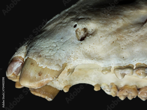Tooth fistula photo