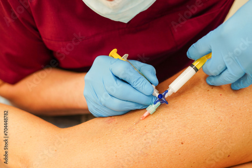 Removal of varicose veins on the legs. Doctor doing sclerotherapy photo