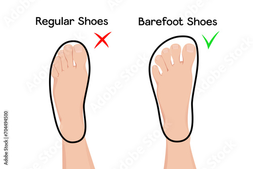 Feet in barefoot and regular shoes vector illustration infographic.