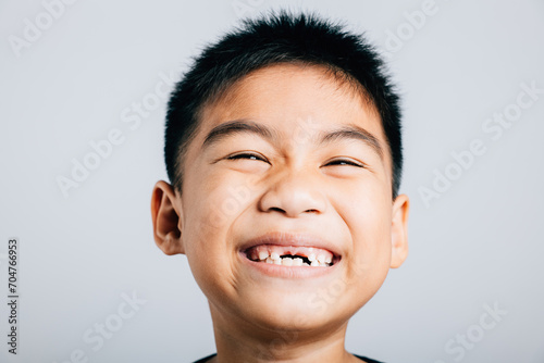 Child smiles upper tooth lost gap evident. Dental growth isolated on white. Joyful tooth fairy moment. Children show teeth new gap, dentist problems. little boy no tooth