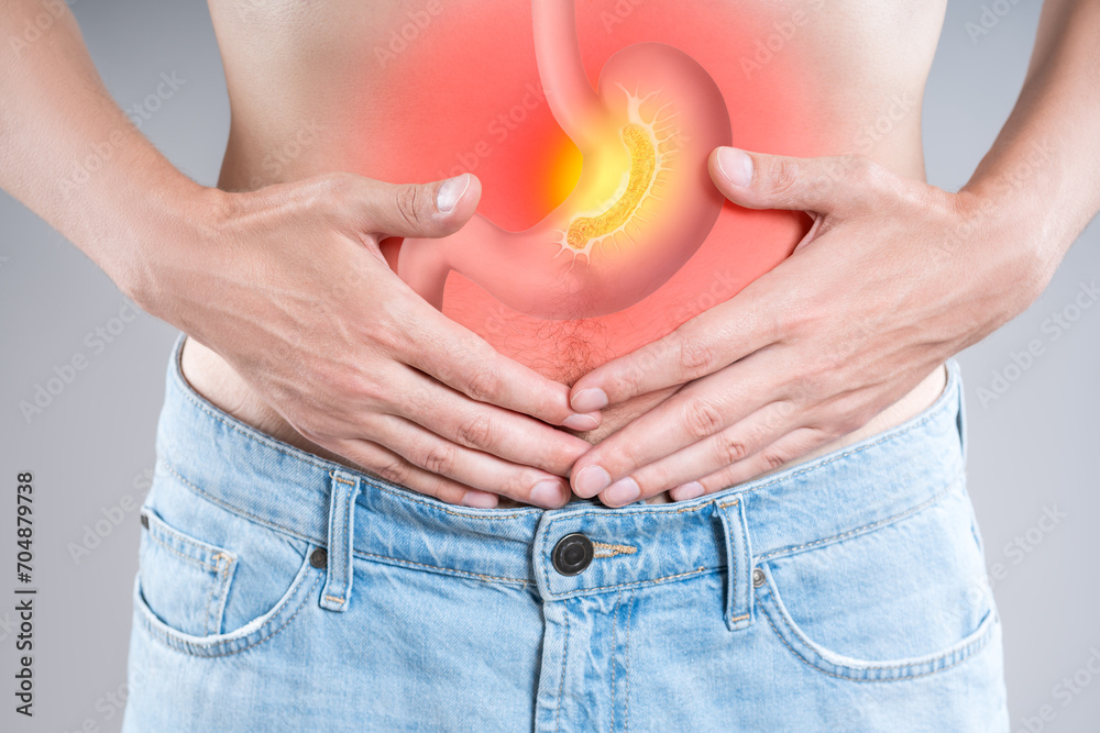 Stomach ulcer, man with abdominal pain suffers from abdomen disease