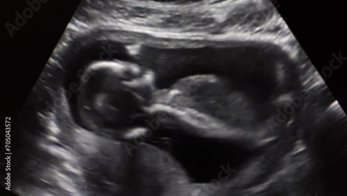 Ultrasound of baby . Human embryo moving on an ultrasound display. Baby in mother's womb during sonography photo