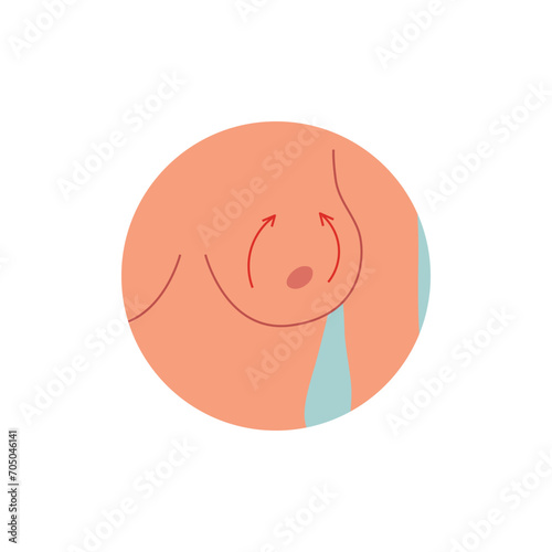 Breast uplift plastic surgery.