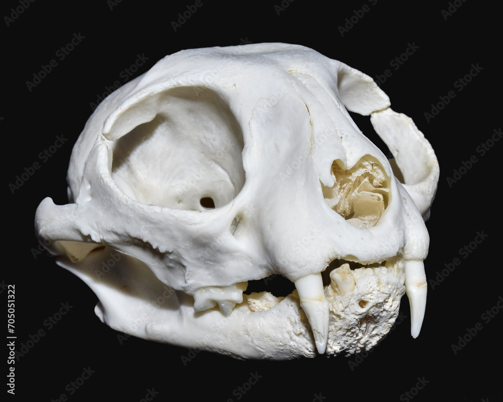 Neoplastic Bone Diseases Neoplastic Bone Diseases
