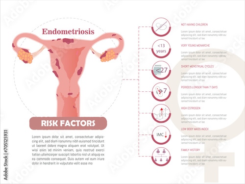 Infographic on risk factors in endometriosis.