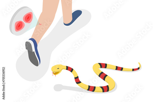 3D Isometric Flat Conceptual Illustration of Poisonous Snake Bit , Venomous Serpent Snap