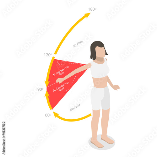 3D Isometric Flat Conceptual Illustration of Painful Arc Test, Rotator Cuff Disorder
