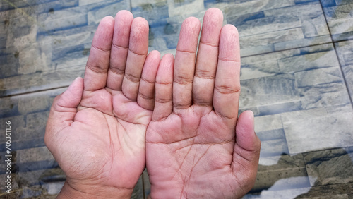 Εκτύπωση καμβά Fingers wrinkled from being in the water for too long