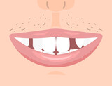 an illustration of a mouth with missing teeth. many teeth are missing and broken. dental condition. health. flat illustration design. graphic elements. vector