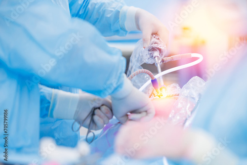 Modern laparoscopic equipment, doctor surgery working, sunlight. Operation process on abdominal, blue light photo