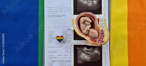 Embryo ultrasound and surrogacy for same-sex marriages photo
