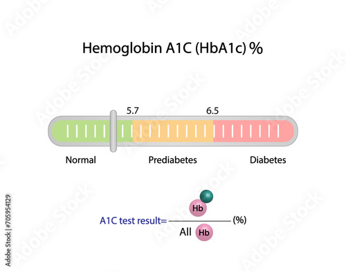 Hemoglobin A1C, HbA1c test , HbA1c levels, Glucose sticks to hemoglobin, glycated hemoglobin, up to 120 days. A1C Blood Sugar Test, Diabetes Mellitus, Infographic, Vector illustration.