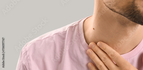 Man with mole on neck against grey background, closeup photo