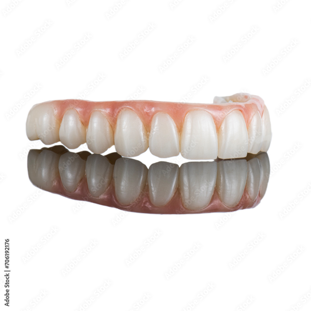 zircon bridge on 8 dental implants zircon bridge on 8 dental implants
