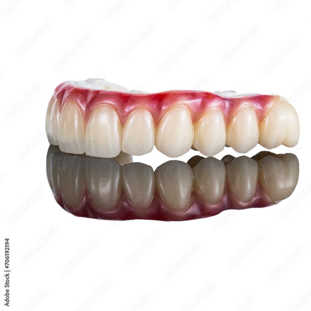 zircon bridge on 8 dental implants zircon bridge on 8 dental implants