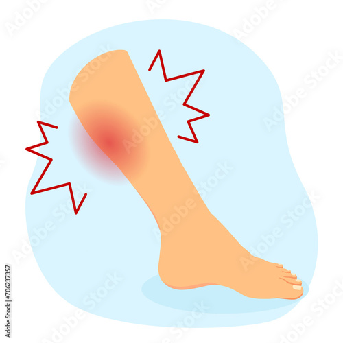 leg cramps