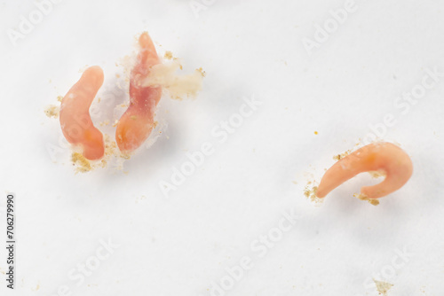 Study of Parasitic helminths (Trematodes) of marine fishes under a microscope. photo