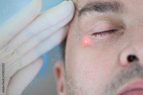 Man Receiving Laser Treatment on Face
 photo