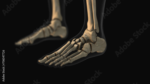 Medical animation of the mid foot pain