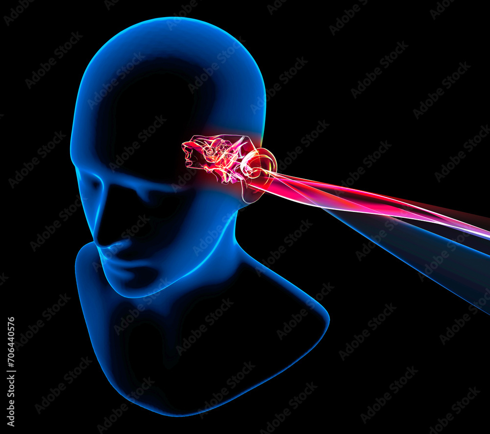 Hearing problems and solutions. Ultrasound. Deafness. Advancing age and