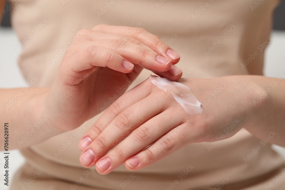Young woman with dry skin applying cream onto her hand, closeup Young woman with dry skin applying cream onto her hand, closeup