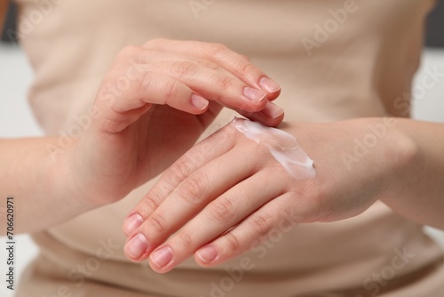 Young woman with dry skin applying cream onto her hand  closeup