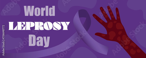 Awareness banner for World Leprosy Day photo
