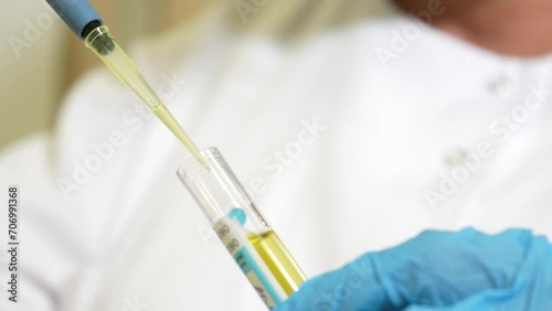 Doctor makes test strip for urine infection