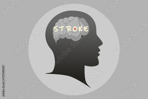 Stroke disease concept. Vector illustration.