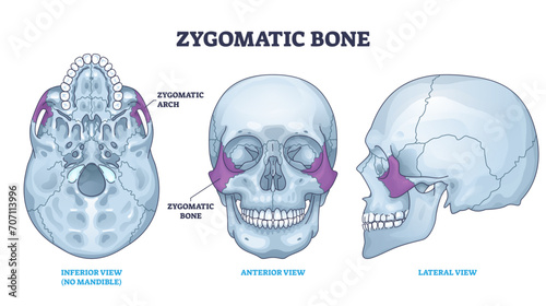 Zygomatic bone location with human skull skeleton anatomy outline diagram, transparent background. Labeled educational scheme with cheekbone from inferior, anterior and lateral view illustration. photo