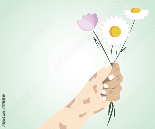 Leper hand holding flowers. Leprosy Day Symbol for Social Media Template Banner with copy space for text. Vector illustration of a background or poster for World Leprosy Day.