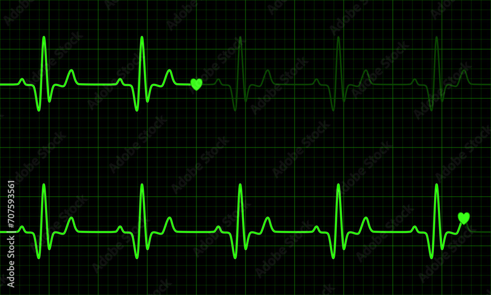Green heart graph on green and black background. Normal sinus rhythm. Vital Sign. Vector Medical Illustration.