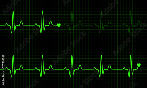 Green heart graph on green and black background. Normal sinus rhythm. Vital Sign. Vector Medical Illustration.