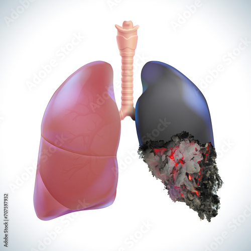3D illustration of one human lung being a healthy lung, the other being an unhealthy lung, burned like the end of a lit cigarette. Used in medicine, advertising, commerce and industry.