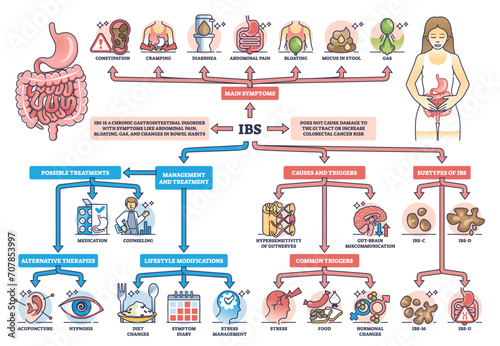 IBS or irritable bower syndrome causes and condition symptoms outline diagram. Labeled educational scheme with digestive system chronic problems vector illustration. Medical gastrointestinal disorder photo