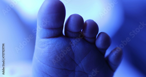 Closeup of infant newborn toddler feet under phototherapy photo