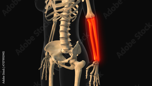 Medical animation of the ulna radius bone pain