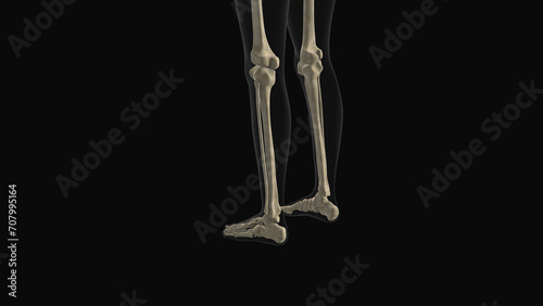 Medical animation of the tibia fibula bone pain