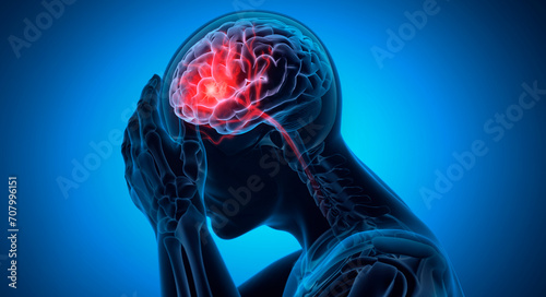 Man with a headache - Brain Stroke - 3D Illustration photo