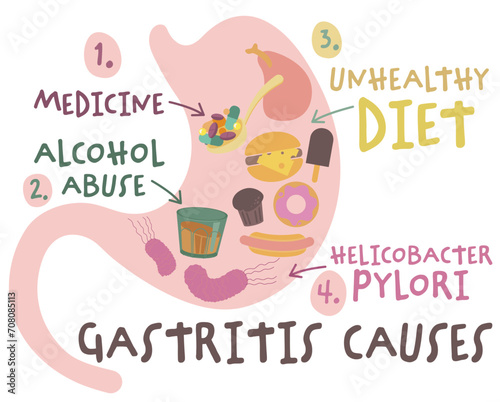 Gastritis causes print in modern cartoon style