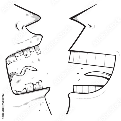 man with good teeth and man with bad teeth