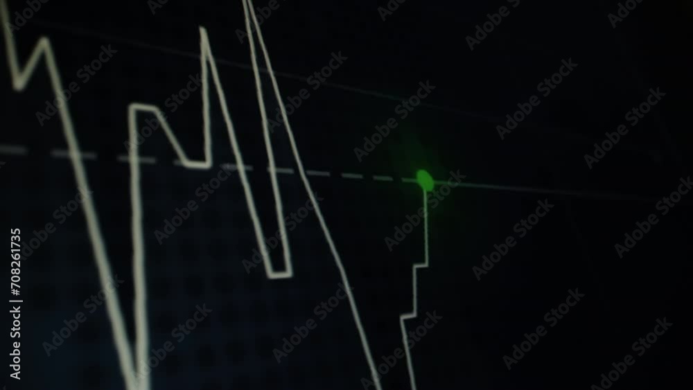 Stock market graph screen monitor with point up and down price or ...
