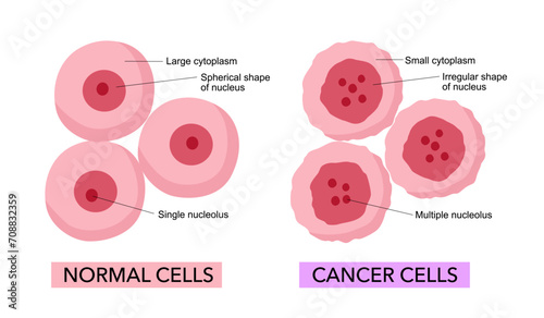 Cancer cells and Normal cells. comparison and difference between healthy tissue and tumor.