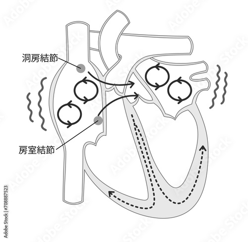 心房細動の刺激伝導系のイラスト白黒
