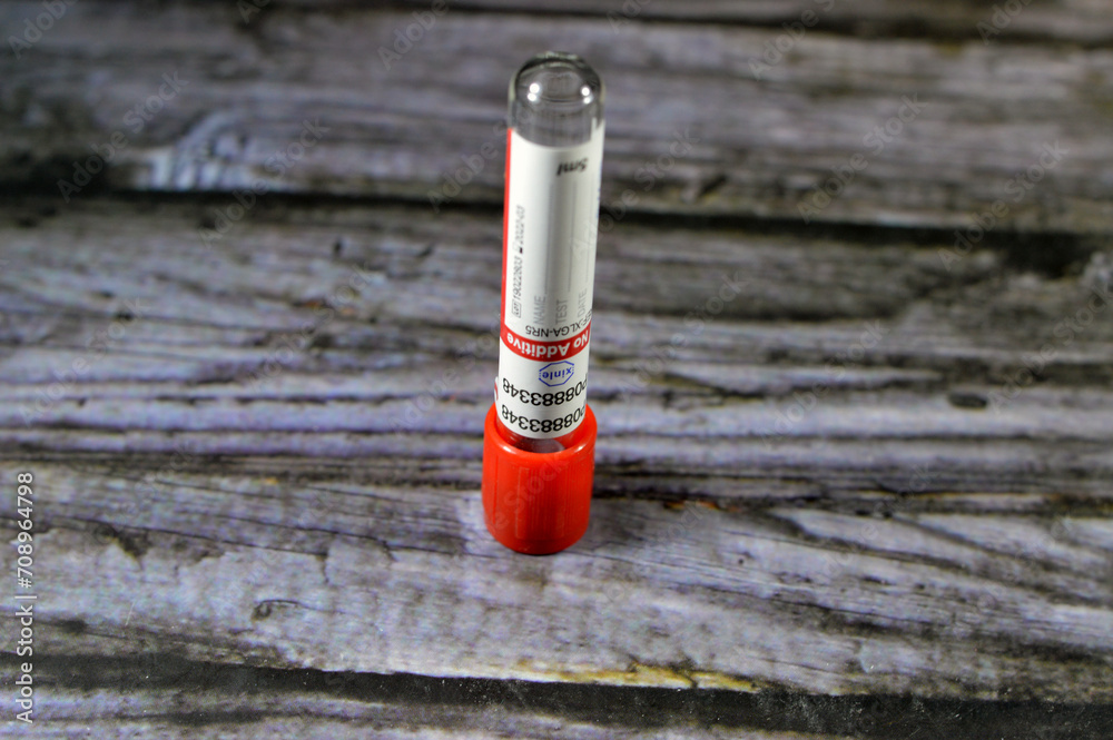 Cairo, Egypt, January 11 2024 Xinle Blood collection tube for collecting blood samples for