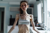 Woman with an eating disorder, anorexia nervosa,  in kitchen 