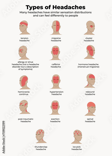 Types of headache. medical poster and infographic.neurology information. Medicine vector illustratuion.